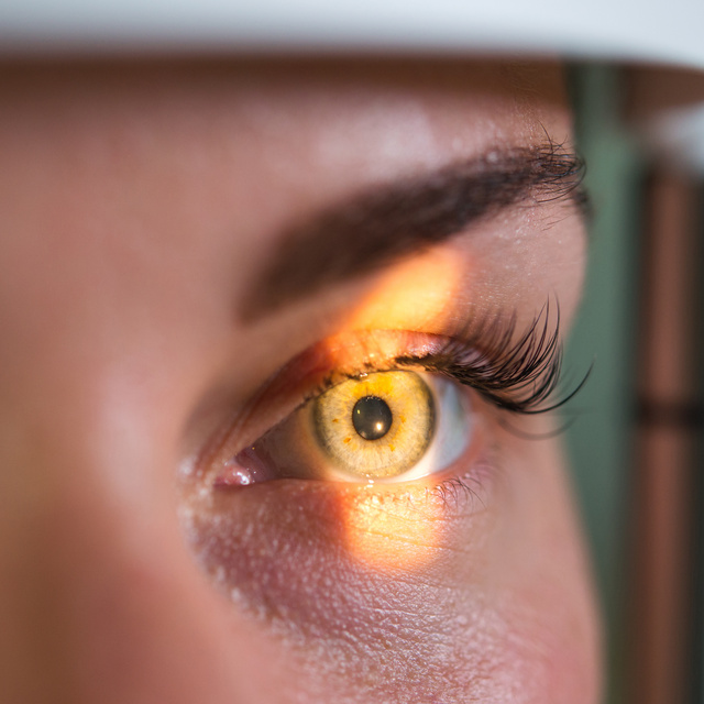 Vision Therapy in St. Henry